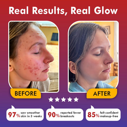 LumaSkin Pro | LED Face Mask